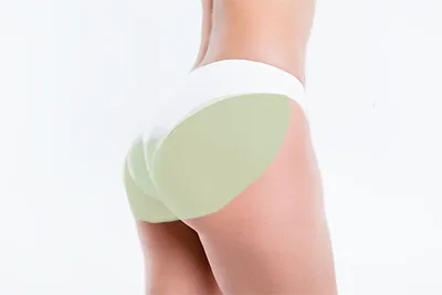Buttocks